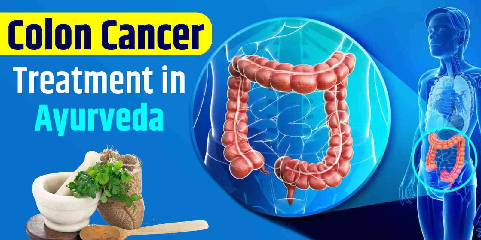 Colon Cancer Treatment in Ayurveda